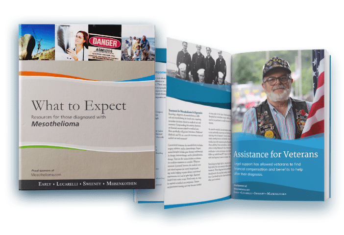 Free Mesothelioma Treatment Guide