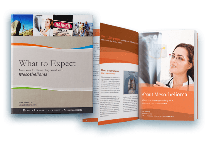 Free Mesothelioma Treatment Guide